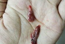 流产可以吃籽瓜嘛,籽瓜的营养益处与适宜食用指南