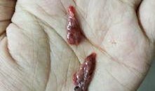 流产可以吃籽瓜嘛,籽瓜的营养益处与适宜食用指南